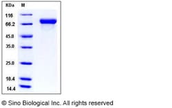 Sino Biological Influenza A H1N1 (A/New York/18/2009) Hemagglutinin / HA
