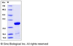Sino Biological Influenza A H1N1 (A/Puerto Rico/8/34/Mount Sinai) Matrix
