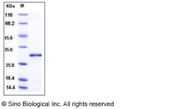 Sino Biological Influenza A H1N1 (A/Puerto Rico/8/34/Mount Sinai) Non-structural