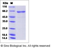 Sino Biological Influenza A H5N1 (A/hubei/1/2010) Hemagglutinin / HA Protein