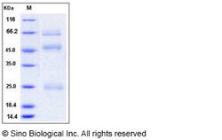 Sino Biological Influenza A H5N1 (A/Hubei/1/2010) Hemagglutinin / HA Protein