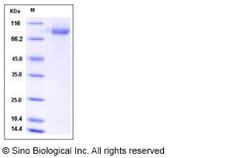 Sino Biological Influenza B (B/Brisbane/60/2008) Hemagglutinin Protein