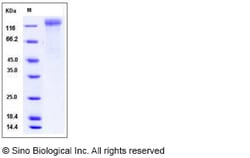Sino Biological Human coronavirus HKU1 (isolate N1) (HCoV-HKU1) Spike/S1