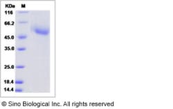 Sino Biological Influenza A H5N1 (A/goose/Guangdong/1/1996) Hemagglutinin
