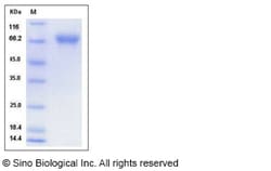 Sino Biological Influenza A H4N8 (A/chicken/Alabama/1/1975) Hemagglutinin