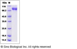 Sino Biological Influenza A H5N1 (A/Cambodia/S1211394/2008) Hemagglutinin