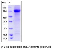 Sino Biological Influenza A H6N4 (A/chicken/Hong Kong/17/1977) Hemagglutinin
