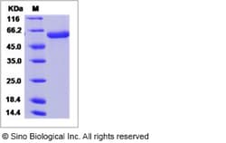 Sino Biological Influenza A H10N9 (A/duck/Hong Kong/562/1979) Hemagglutinin