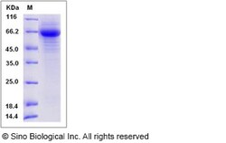 Sino Biological Influenza A H10N9 (A/duck/Hong Kong/562/1979) Hemagglutinin