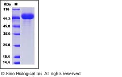 Sino Biological Influenza A H9N2 (A/chicken/Hong Kong/G9/1997) Neuraminidase