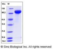 Sino Biological Influenza A H1N1 (A/Beijing/22808/2009) Hemagglutinin Protein
