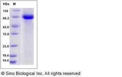 Sino Biological Influenza A H9N2 (A/chicken/Hong Kong/G9/1997) Hemagglutinin