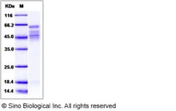 Sino Biological Human respiratory syncytial virus (RSV) Fusion protein