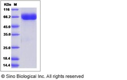 Sino Biological Influenza A H9N2 (A/Hong Kong/1073/99) Neuraminidase /