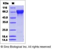Sino Biological Influenza A H3N2 (A/Perth/16/2009) Hemagglutinin / HA-specific