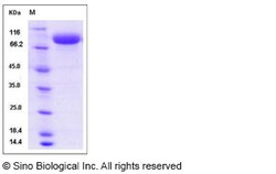 Sino Biological Influenza A H3N2 (A/Perth/16/2009) Hemagglutinin / HA Protein