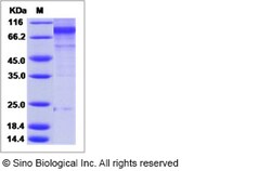 Sino Biological Influenza A H3N2 (A/Perth/16/2009) Hemagglutinin / HA0