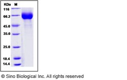 Sino Biological Influenza A H3N2 (A/reassortant/IVR-155(Victoria/210/2009