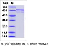 Sino Biological Influenza A H3N2 (A/X-31) Hemagglutinin / HA Protein (His
