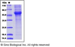 Sino Biological Influenza A H5N1 (A/Thailand/1(KAN-1)/2004) Neuraminidase