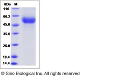 Sino Biological Influenza A H5N1 (A/Thailand/1(KAN-1)/2004) Hemagglutinin