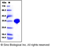 Sino Biological Recombinant Listeria monocytogenes flagellin Protein (His
