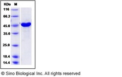Sino Biological MERS-CoV Nucleocapsid Protein (His Tag), Quantity: Each