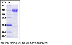 Sino Biological MERS-CoV Spike Protein (S1+S2 ECD, aa 1-1297, His Tag),