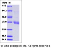 Sino Biological MERS-CoV Spike/RBD Protein fragment (RBD, aa 367-606, His