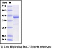 Sino Biological MERS-CoV Spike/RBD Protein fragment (RBD, aa 367-606, rFc