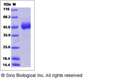 Sino Biological Ebola virus EBOV (Subtype Sudan, strain Gulu) Glycoprotein