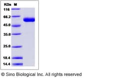 Sino Biological Influenza A H7N9 (A/Anhui/1/2013) Hemagglutinin / HA Protein