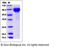 Sino Biological Influenza A H7N9 (A/Anhui/1/2013) Hemagglutinin / HA Protein