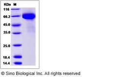 Sino Biological Influenza A H7N9 (A/Shanghai/1/2013) Hemagglutinin Protein
