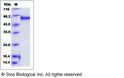 Sino Biological Influenza A H7N9 (A/Hangzhou/1/2013) Hemagglutinin / HA