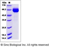 Sino Biological Influenza A H7N9 (A/Hangzhou/1/2013) Hemagglutinin / HA
