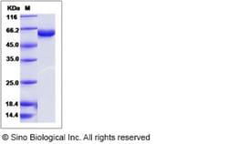 Sino Biological Influenza A H7N9 (A/Pigeon/Shanghai/S1069/2013) Hemagglutinin