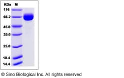 Sino Biological Influenza A H7N9 (A/Pigeon/Shanghai/S1069/2013) Hemagglutinin
