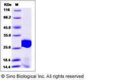 Sino Biological Influenza A H7N9 (A/Anhui/1/2013) Matrix protein 1 / M1