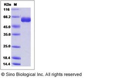 Sino Biological Influenza A H7N9 (A/Zhejiang/1/2013) Hemagglutinin / HA