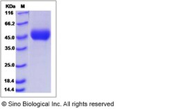 Sino Biological Influenza A H7N3 (A/turkey/Italy/214845/2002) Hemagglutinin