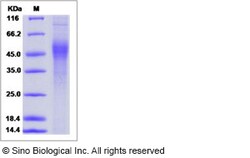 Sino Biological Influenza A H7N3 (A/chicken/SK/HR-00011/2007) Hemagglutinin