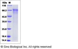 Sino Biological Influenza A H1N1 (A/Taiwan/01/1986) Hemagglutinin / HA