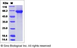 Sino Biological Influenza A H1N9 (A/mallard/Ohio/265/1987) Hemagglutinin