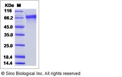 Sino Biological Influenza A H3N1 (A/swine/Korea/PZ72-1/2006) Hemagglutinin