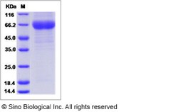 Sino Biological Influenza A H3N1 (A/swine/Korea/PZ72-1/2006) Hemagglutinin