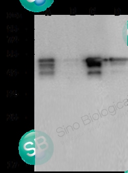 Sino Biological SARS-CoV/SARS-CoV-2 Nucleocapsid Antibody, Rabbit MAb,