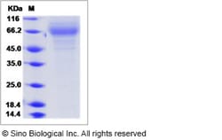 Sino Biological Influenza A H3N2 (A/Wisconsin/15/2009) Hemagglutinin /