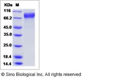Sino Biological Influenza A H3N2 (A/Victoria/361/2011) Hemagglutinin /