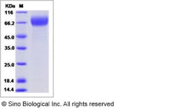 Sino Biological Influenza A H3N2 (A/Victoria/361/2011) Hemagglutinin Protein